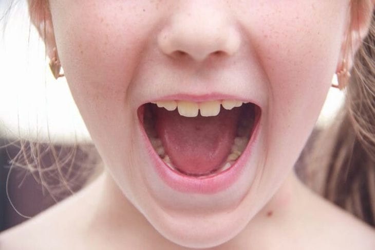 ¿Por qué se llaman así los dientes de leche? Los antiguos griegos saben la respuesta Dientes