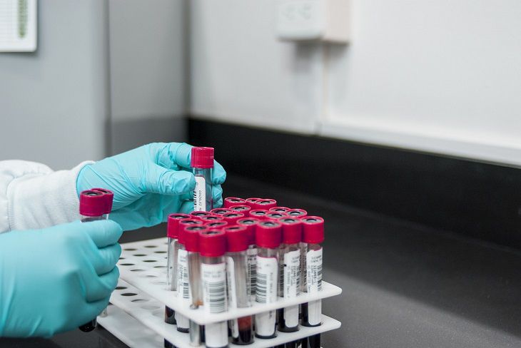 Hundreds of vials containing deadly viruses disappear from Australian lab test tubes