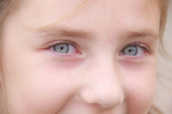 5 mythes sur les soins de la peau auxquels beaucoup de femmes croient encore : vous pouvez les ignorer en toute sécurité Affronter