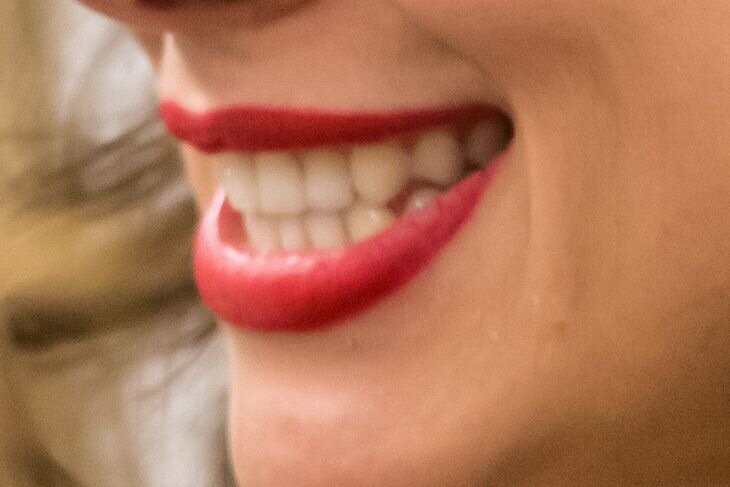 Who wears the world's most expensive dental plaque: it costs exactly one million dollars Teeth